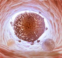 Đã tìm ra cách loại bỏ vi rút HIV khỏi cơ thể