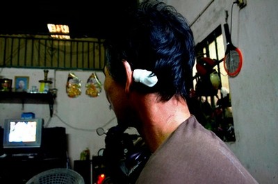 Anh Nam với vết thương ở vùng đầu