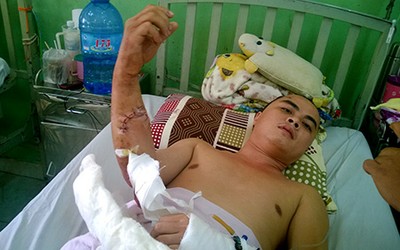 Chủ quán thịt chó bị chém trọng thương