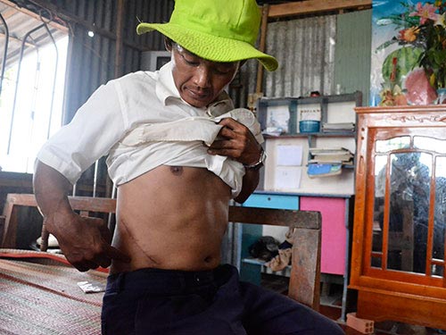 Đau đớn bán thận chui: Nhận tiền, mất mạng